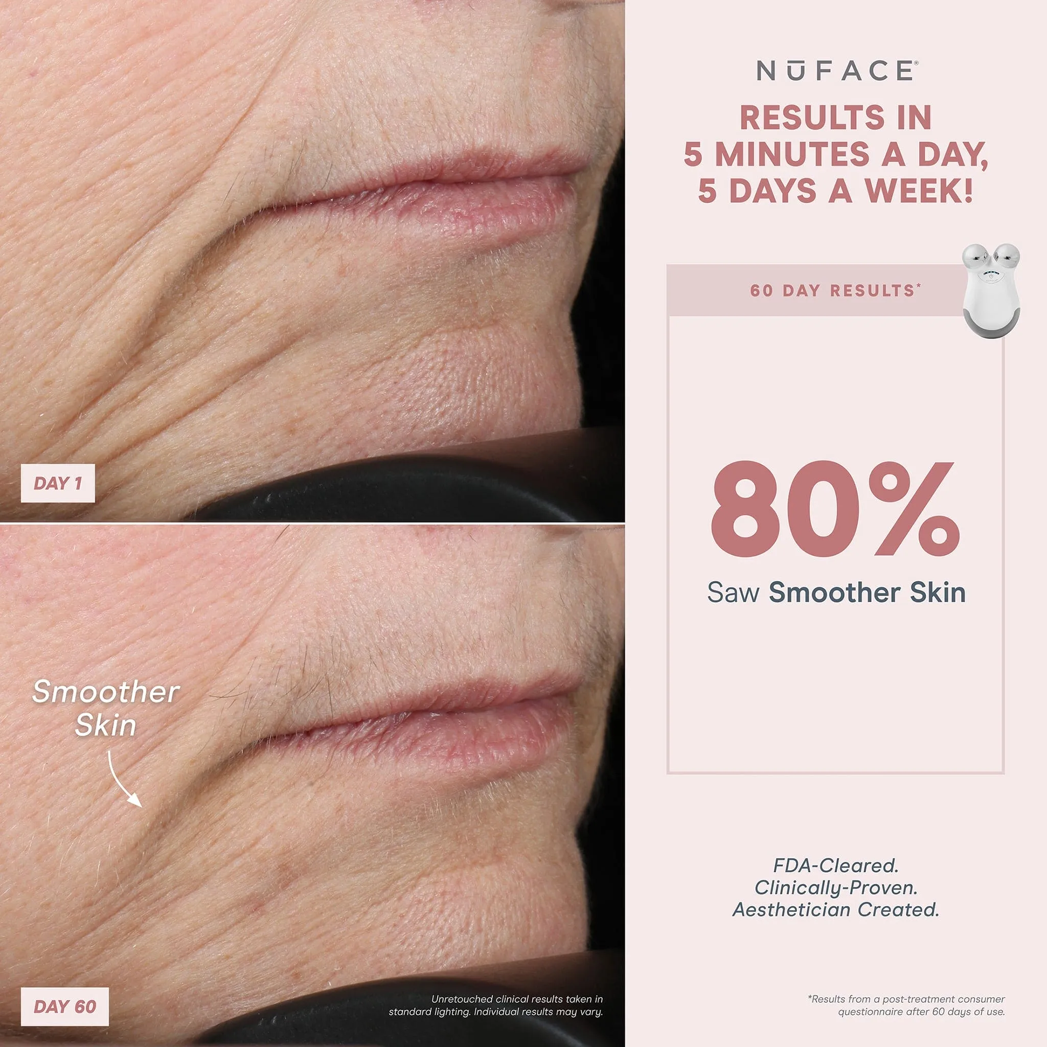 NuFACE Microcurrent Facial Toning Device