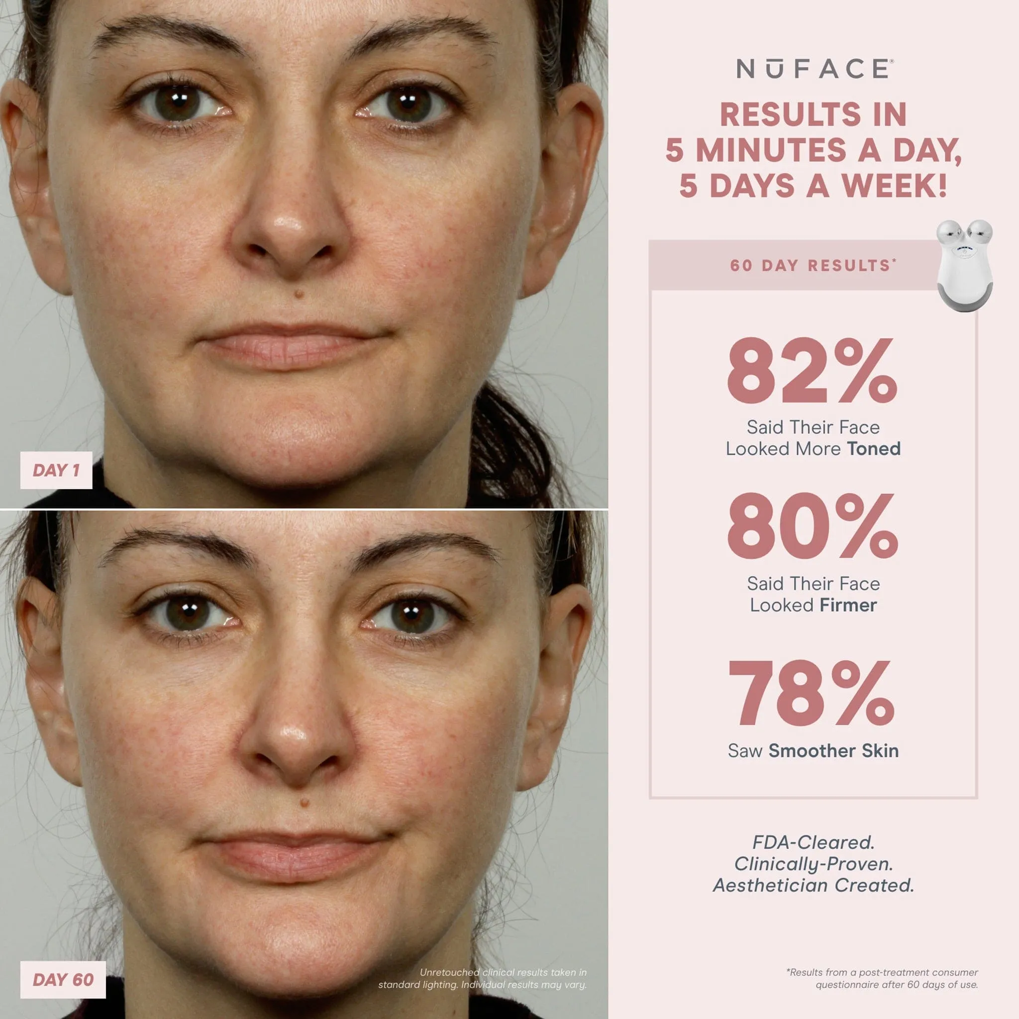 NuFACE Microcurrent Facial Toning Device