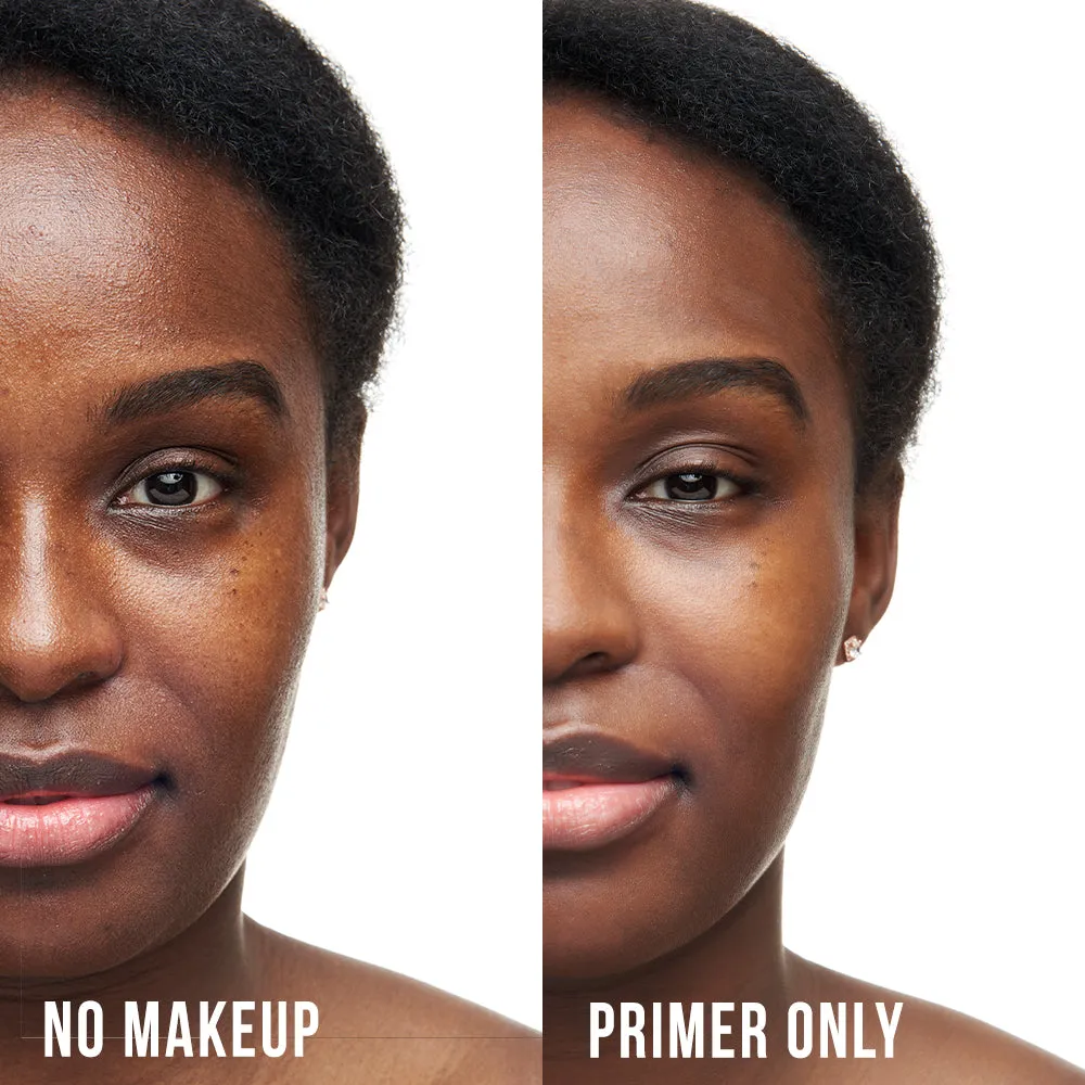 Perfect Skin Bundle