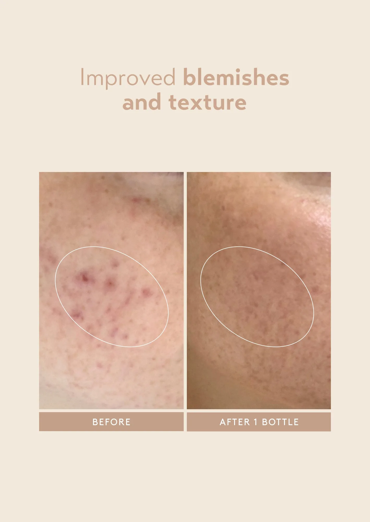 Retinol Reform®