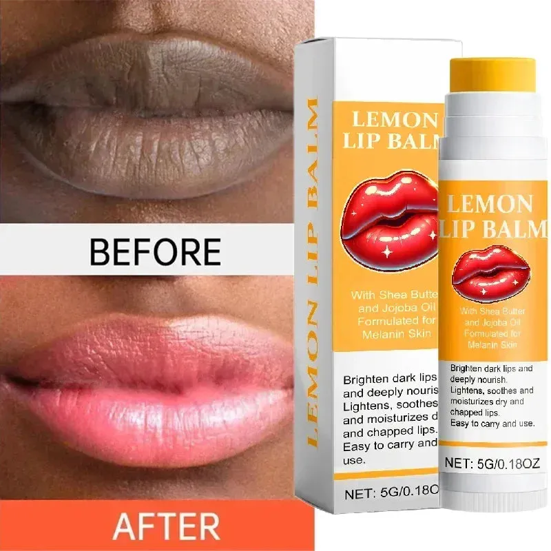Turmeric Lip Balm