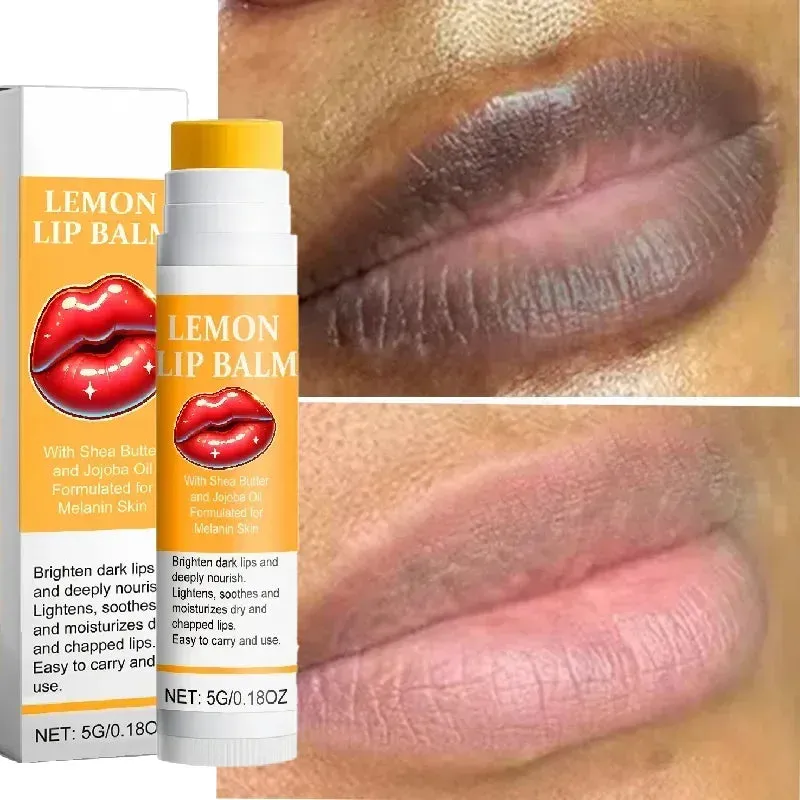 Turmeric Lip Balm